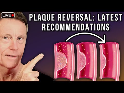 Plaque Reversal: Latest Bale-Doneen Recommendations (Ft. Dr. Bale & Dr. Doneen)