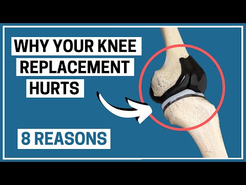 Why is your Knee Replacement painful? 8 possible reasons