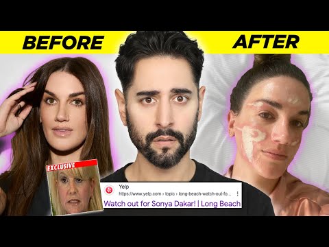 The Celebrity Esthetician Who DESTROYS Clients Skin - When Beauty Turns Ugly