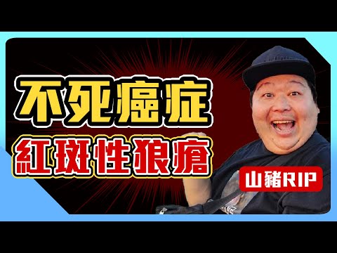 「不死癌症」紅斑性狼瘡有多可怕? 藝人山豬RIP...