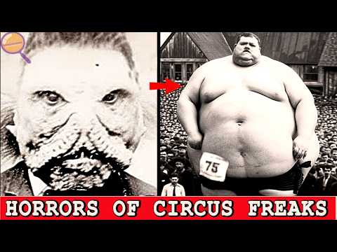 30 BANNED Circus FREAKS That Actually Existed