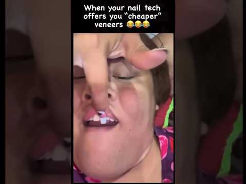 Why You SHOULDN'T Let Your Nail Tech Give You Veneers! 😭🦷