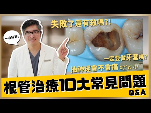 【蛀牙 #7】根管治療10大常見問題大公開！抽神經會不會痛？抽完神經還會痛正常嗎？根管治療後一定要做牙套嗎？一般根管治療與顯微根管治療有什麼差別？｜【祐民牙醫－隱適美旗艦店】鑽石級楊大為醫師