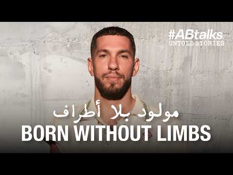 Born Without Limbs • مولود بلا أطراف | #ABtalks Untold Stories with Nick Santonastasso | Story 19