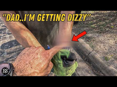 My Son SLIPPED with the PRUNERS and THIS Happened! 