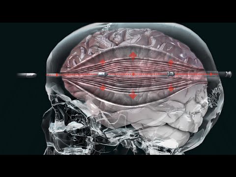 10 People Who Became GENIUSES from BRAIN DAMAGE