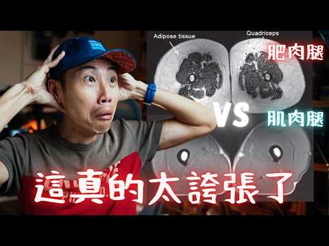 連醫學專家都弄錯肌少症了!破解 1 個能改變你人生下半場的迷思(請一定要分享給你家長輩)