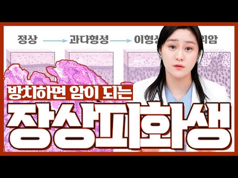 (ENG)장상피화생은 위암으로 이어질까? 내시경 후 장상피화생을 진단 받았다면 필수 시청!