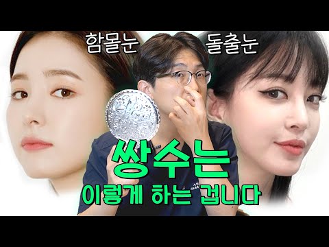 돌출눈 함몰눈 쌍수 라인 선택과 수술 방법 - 정말 좋은 내용입니다. 꼭 도움이 되시길 바라요