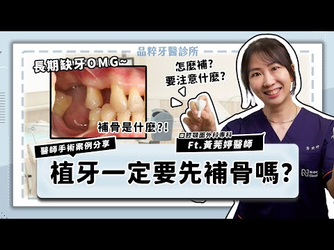 植牙一定要先補骨嗎？植牙前補骨方法、原理、適用情況全都告訴你！＿ft.黃莞婷醫師｜品粹牙醫