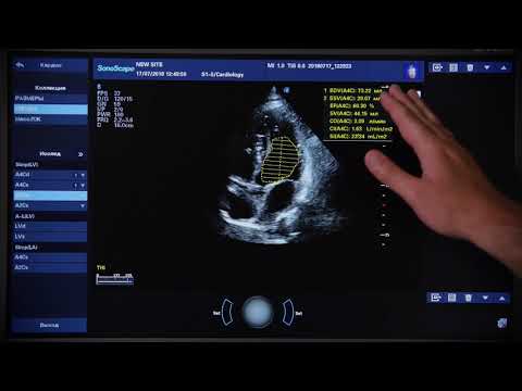S40Exp 9 Cardio Calculations
