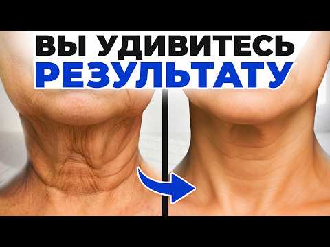 Дряблая кожа на шее, второй подбородок, брыли, морщины и всё из-за ЭТОЙ мышцы