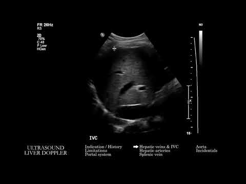 [US] Liver Doppler Ultrasound | Search Pattern
