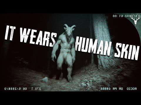 I Dare You to Go Camping After Listening to This