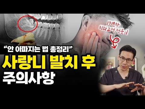 사랑니 발치 후 통증이 싫다면 꼭 보세요-! | 치과의사가 알려주는 사랑니 발치 후 주의사항
