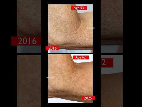 BEST Skincare for CREPEY Body Skin! #skincare #over40skincare  #crepeyskinfix