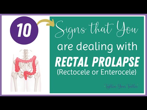 10 Signs that you are dealing with Rectal Prolapse (Rectocele)