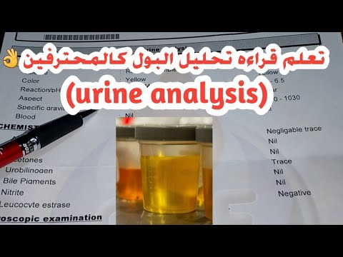 تعلم قراءه تحليل البول كالمحترفين (urine analysis)