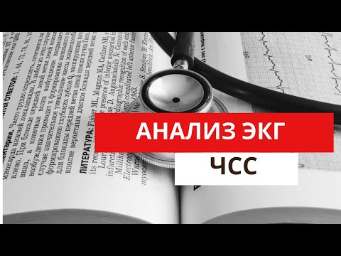 Анализ ЭКГ. Определение ЧСС (частоты сердечных сокращений).