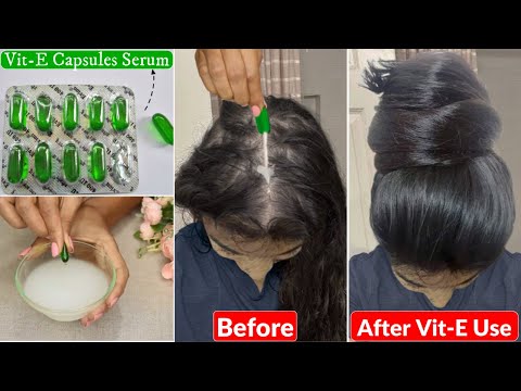 I applied👆🏼this Vitamin-E Hair Mix-Hair Growth got Tripled-Increase Hair Density, Thickness & Length