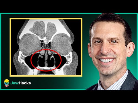 Can Turbinate Surgery Cause Empty Nose Syndrome? (Surgeon Explains)