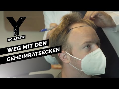 Haartransplantation in der Türkei - Schönheitsoperationen bei Männern | Y-Kollektiv