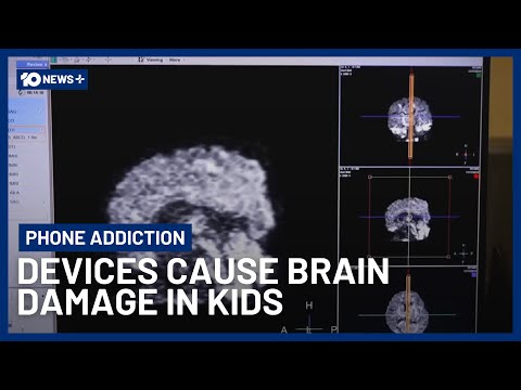Chilling Warning For Parents As MRI Scans Show Phones Are Damaging Kids' Brains | 10 News+