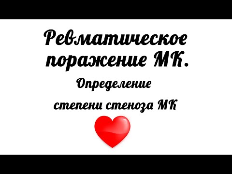 Ревматическое поражение митрального клапана. Митральный стеноз 2 степени. Способы определения МС.