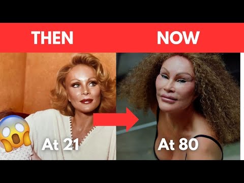 You Won't Believe How These Stars Changed After Plastic Surgery!