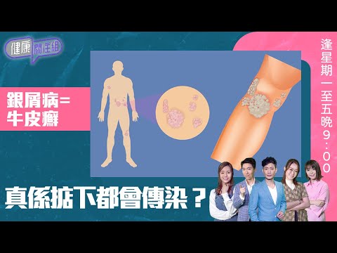健康關注組 ｜ 銀屑病=牛皮癬 真係掂下都會傳染？ ｜ HOY TV 77台 ｜ 敖嘉年 ｜ 梁嘉琪 ｜ 林曉蕙 ｜ 第42集