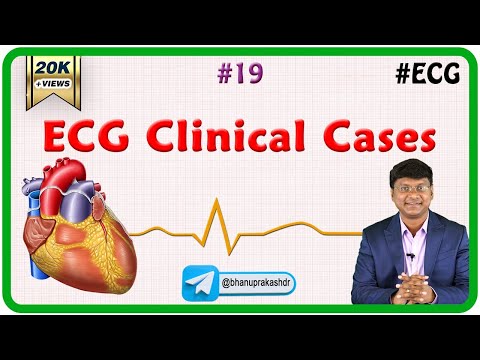 19. ECG Clinical cases