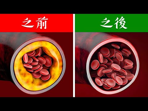 清理血管,要吃什麼? 9種食物保健心臟、心血管自然療法,柏格醫生 Dr Berg