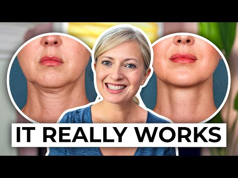 How to Lift Your Neck Without Surgery – Expert Reveals the Method!