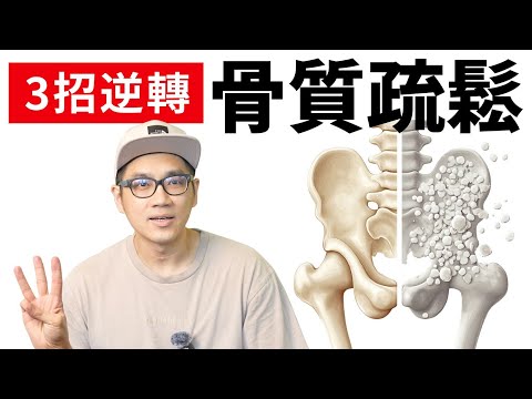 骨質疏鬆可逆轉,「2款運動」+「1個飲食」助你天然提升骨質密度!