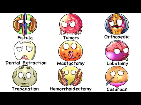 Every PAINFUL Surgery Explained in 17 Minutes