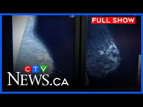 Doctors worried about higher wait times  | CTV News Calgary at 5 for April 22, 2026