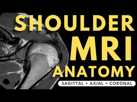 Shoulder MRI Anatomy | Radiology anatomy part 1 prep | How to interpret a shoulder MRI