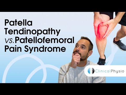 Patella Tendinopathy vs. Patellofemoral Pain Syndrome | Expert Physio Guide