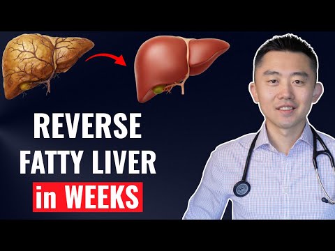 The FASTEST Way to Reverse Fatty Liver, Naturally