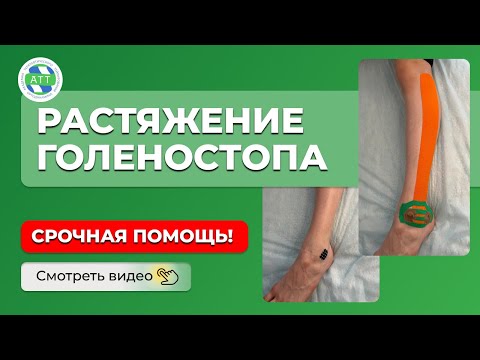 Растяжение связок голеностопного сустава. Тейпирование голеностопного сустава. Тейпирование стопы