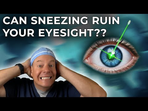 What If You Move During LASIK? Doctor Reveals the Facts