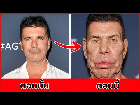 การเปลี่ยนแปลงศัลยกรรมผู้ชายที่น่าตกตะลึง | ก่อนและหลังที่คุณคาดไม่ถึง