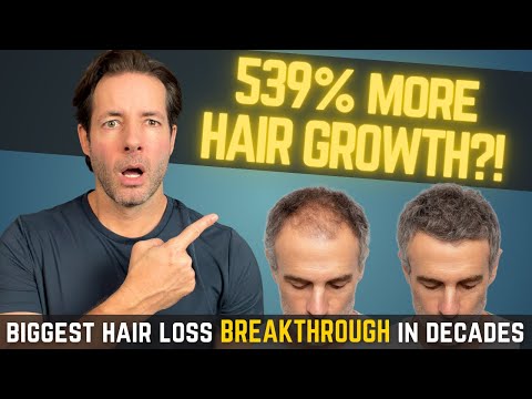 The New Hair Loss Breakthrough: Clascoterone 5% Phase 3 Results Explained