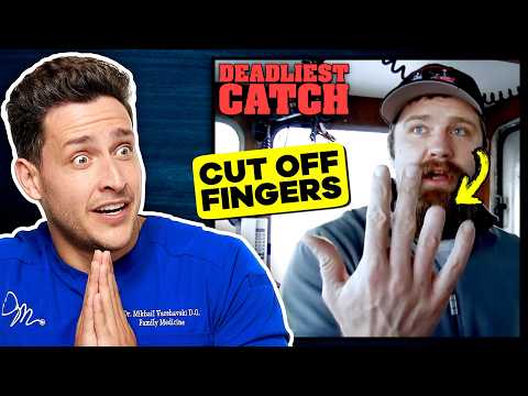 Doctor Reacts To Deadliest Catch Injuries