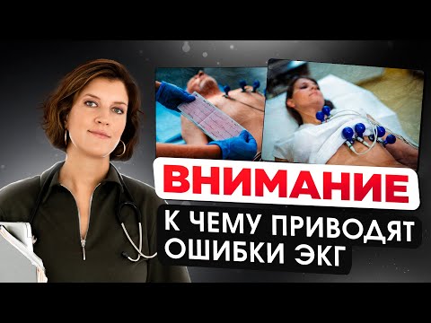 Самая частая ошибка ЭКГ. Как обнаружить проблемы с сердцем?