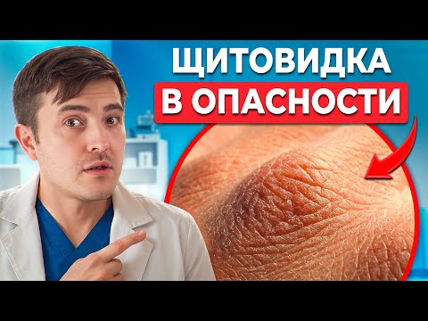 Как кожа предупреждает о ПРОБЛЕМАХ С ЩИТОВИДКОЙ? Заметь, пока не поздно!