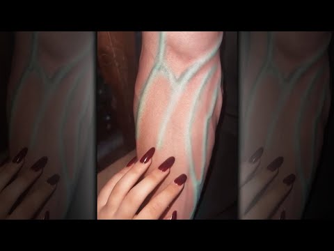 Bro Is Every Nurses Dream💀