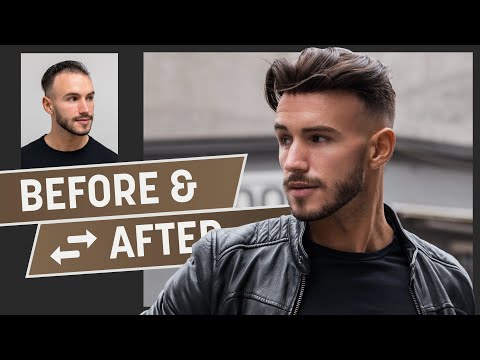 The fastest way to full hair? A Heydecke transformation is the solution