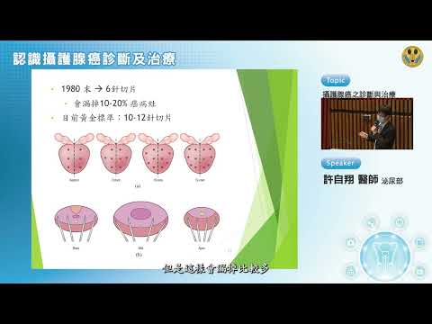 2攝護腺癌診斷及治療 許自翔