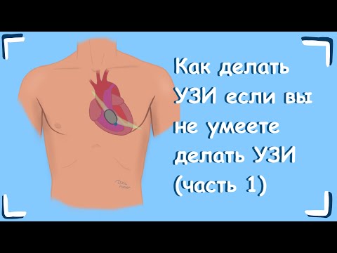 Как делать УЗИ если вы не умеете делать УЗИ (часть 1)